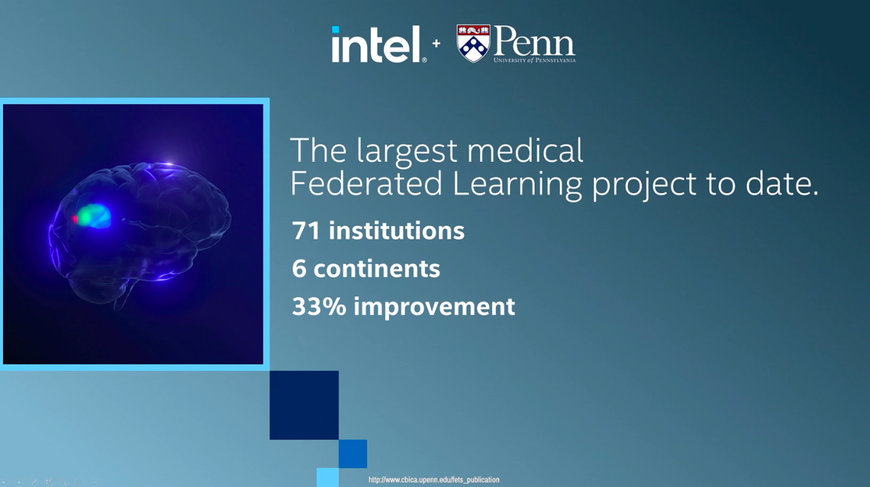 Intel and Penn Medicine Announce Results of Largest Medical Federated Learning Study